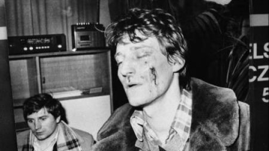 Reprodukcja zdjęcia - Mariusz Łabentowicz pobity przez milicję. Bydgoszcz, 1981.03.19. Fot. PAP/CAF/S. Kraszewski 