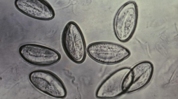 Jajeczka owsika ludzkiego. Źródło: pl.wikipedia