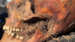 Zdjęcie z ekshumacji. Między zębami zmarłego widać paciorki różańca. Fot. Fundacja Latebra 