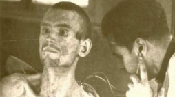 Badanie lekarskie jeńca rosyjskiego, więźnia obozu w Łambinowicach. Fot. IPN/Archiwum CMJW w Łambinowicach-Opolu 
