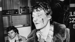 Reprodukcja zdjęcia - Mariusz Łabentowicz pobity przez milicję. Bydgoszcz, 1981.03.19. Fot. PAP/CAF/S. Kraszewski 