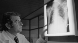 Zabrze 10.1985. Kierownik Wojewódzkiego Ośrodka Kardiologii (Śląskie Centrum Chorób Serca) doc. Zbigniew Religa. PAP/S. Jakubowski 