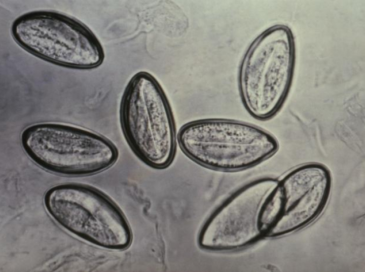 Pasożyty jelitowe zidentyfikowane w odchodach sprzed tysiąca lat