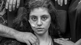 Zdjęcie T. Kaczora "Przebudzenie" ukazujące nastoletnią Ormiankę cierpiącą na syndrom rezygnacji. 