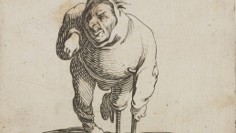 Jacquesa Callota z XVII w. przedstawiająca osobę niepełnosprawną. Źródło: CBN Polona