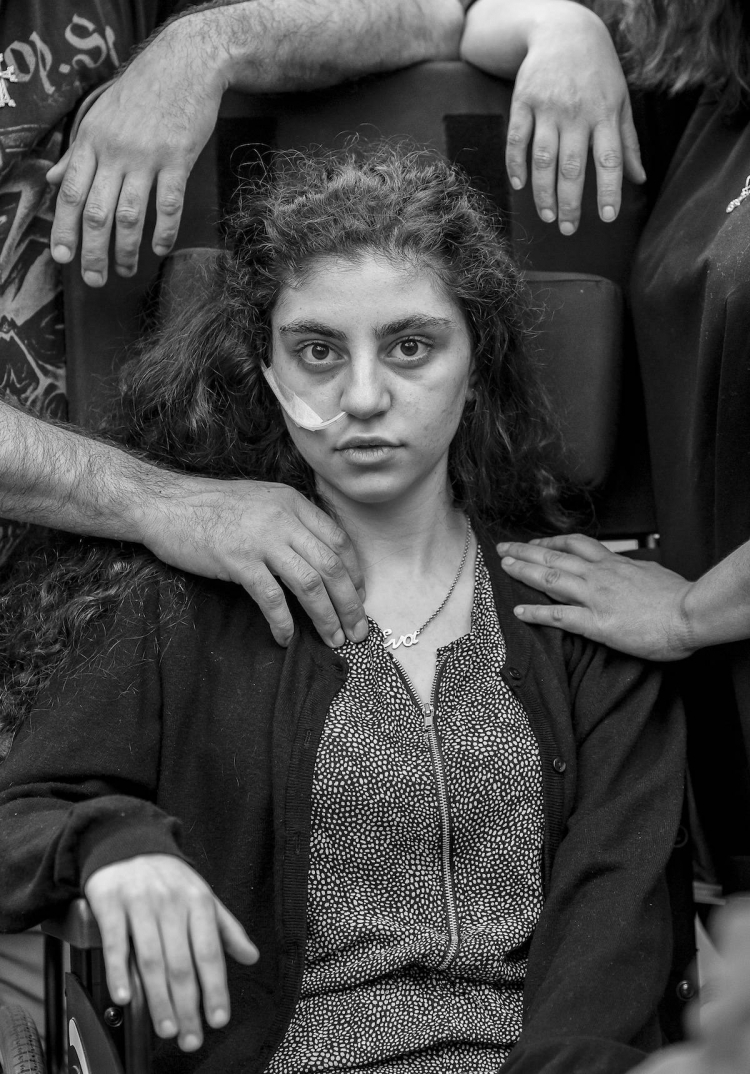 Zdjęcie T. Kaczora "Przebudzenie" ukazujące nastoletnią Ormiankę cierpiącą na syndrom rezygnacji. 