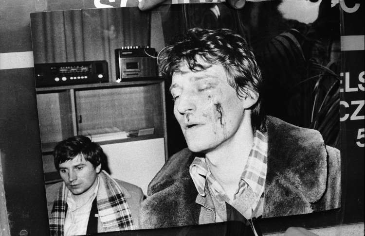 Reprodukcja zdjęcia - Mariusz Łabentowicz (P) po pobiciu przez funkcjonariuszy Milicji Obywatelskiej podczas sesji Wojewódzkiej Rady Narodowej w Bydgoszczy, 1981 r. Fot. PAP/CAF/Stefan Kraszewski