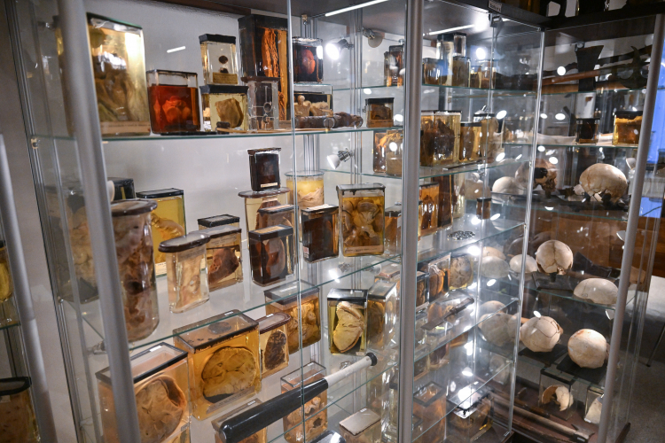Niektóre eksponaty w Muzeum Medycyny Sądowej Uniwersytetu Medycznego we Wrocławiu. Fot. PAP/Maciej Kulczyński 